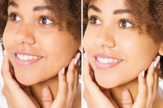Before-and-after collage showing smoother skin