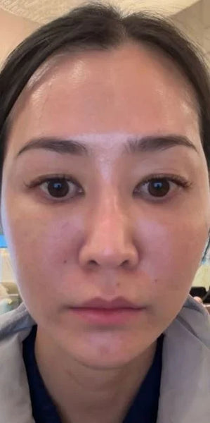 After - Emily