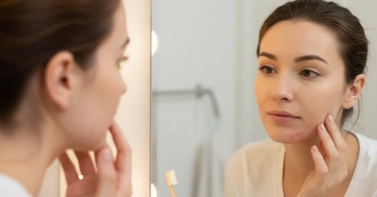 Woman experiencing PMS hormonal skin sensitivity and breakouts during luteal phase