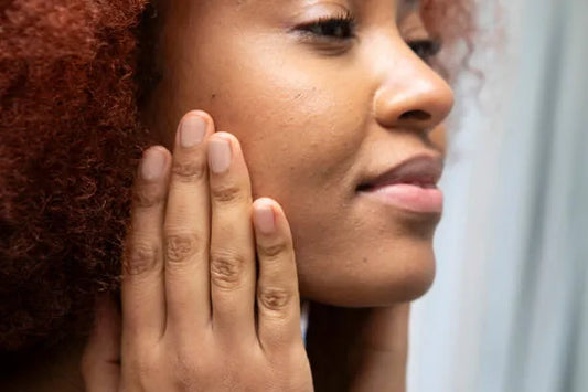 microneedling for acne scars results