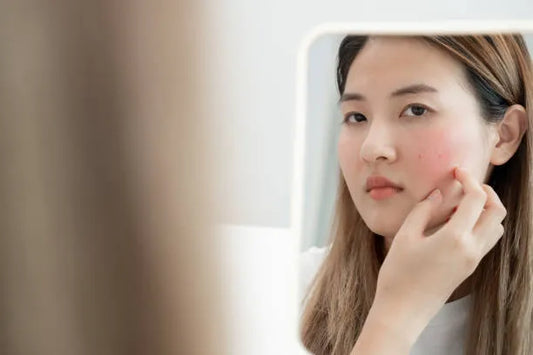 microneedling redness recovery time