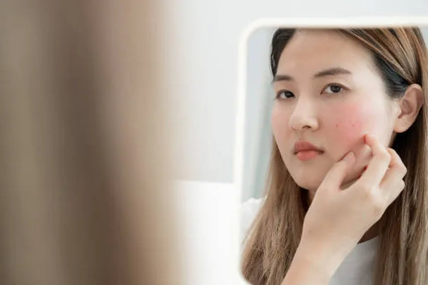 microneedling redness recovery time