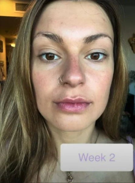 After - Rachel