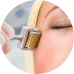 Derma Roller At-Home Treatment
